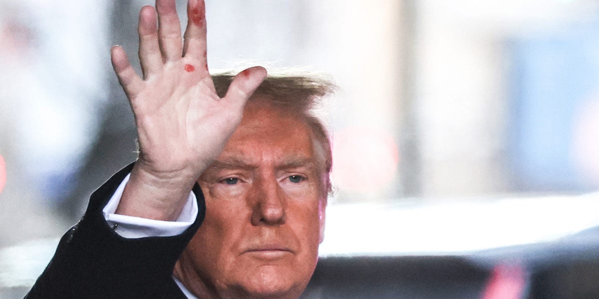 Donald Trump suggère que les mystérieuses marques rouges sur ses mains pourraient être générées par l'IA